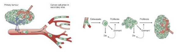 Different stages of metastasis: intravasation, circulation, extravasation, colonisation